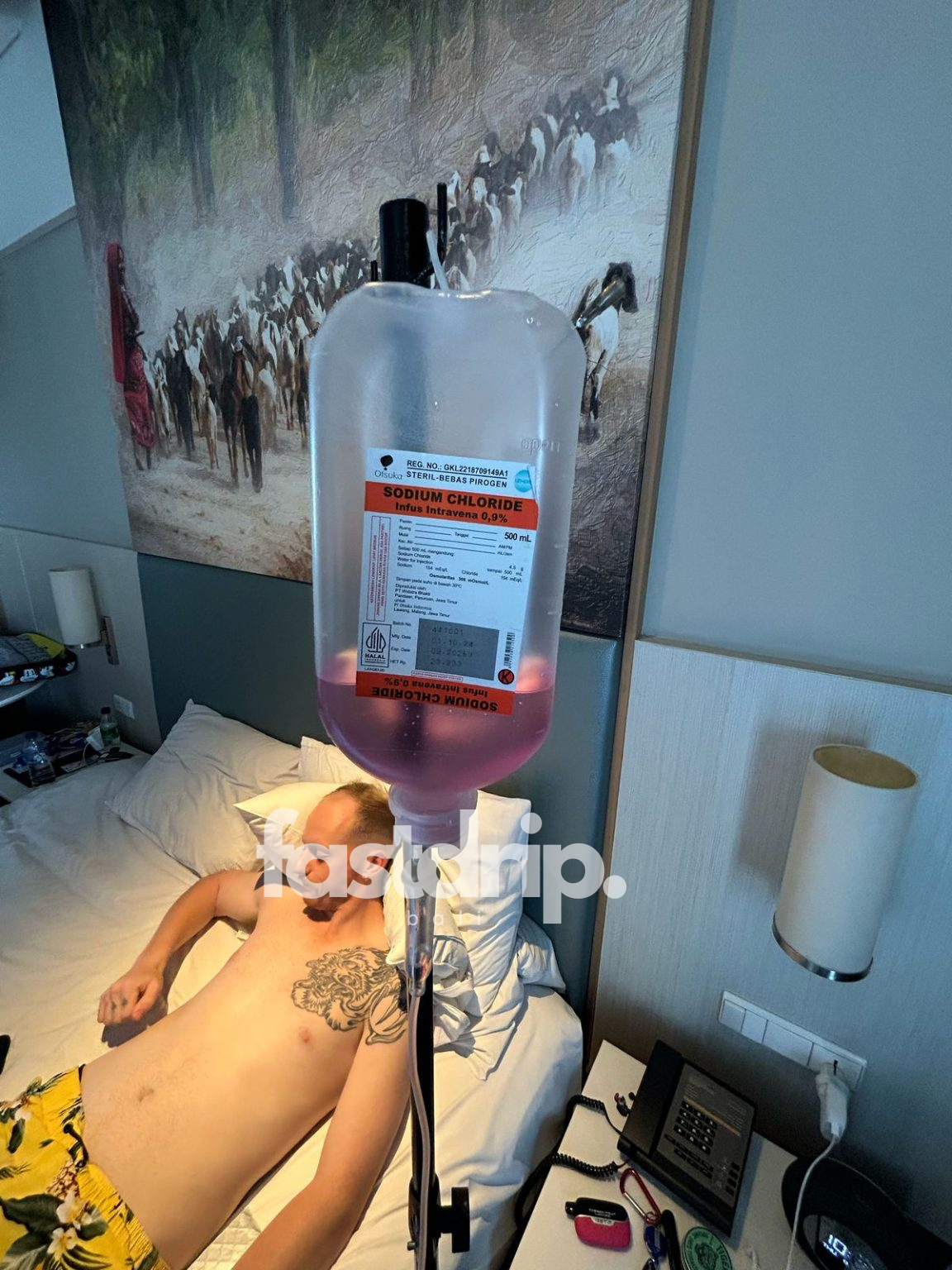 IV Drip Bali - Infusion Bali Belly