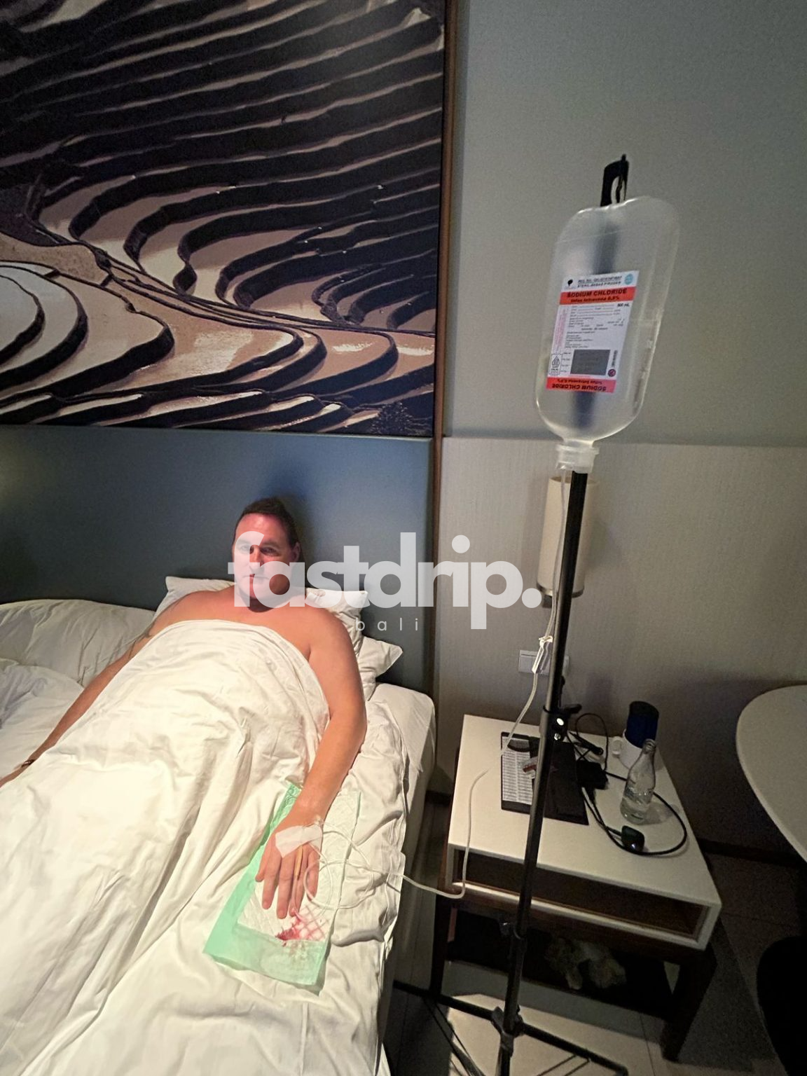 IV Drip Bali - Infusion Bali Belly