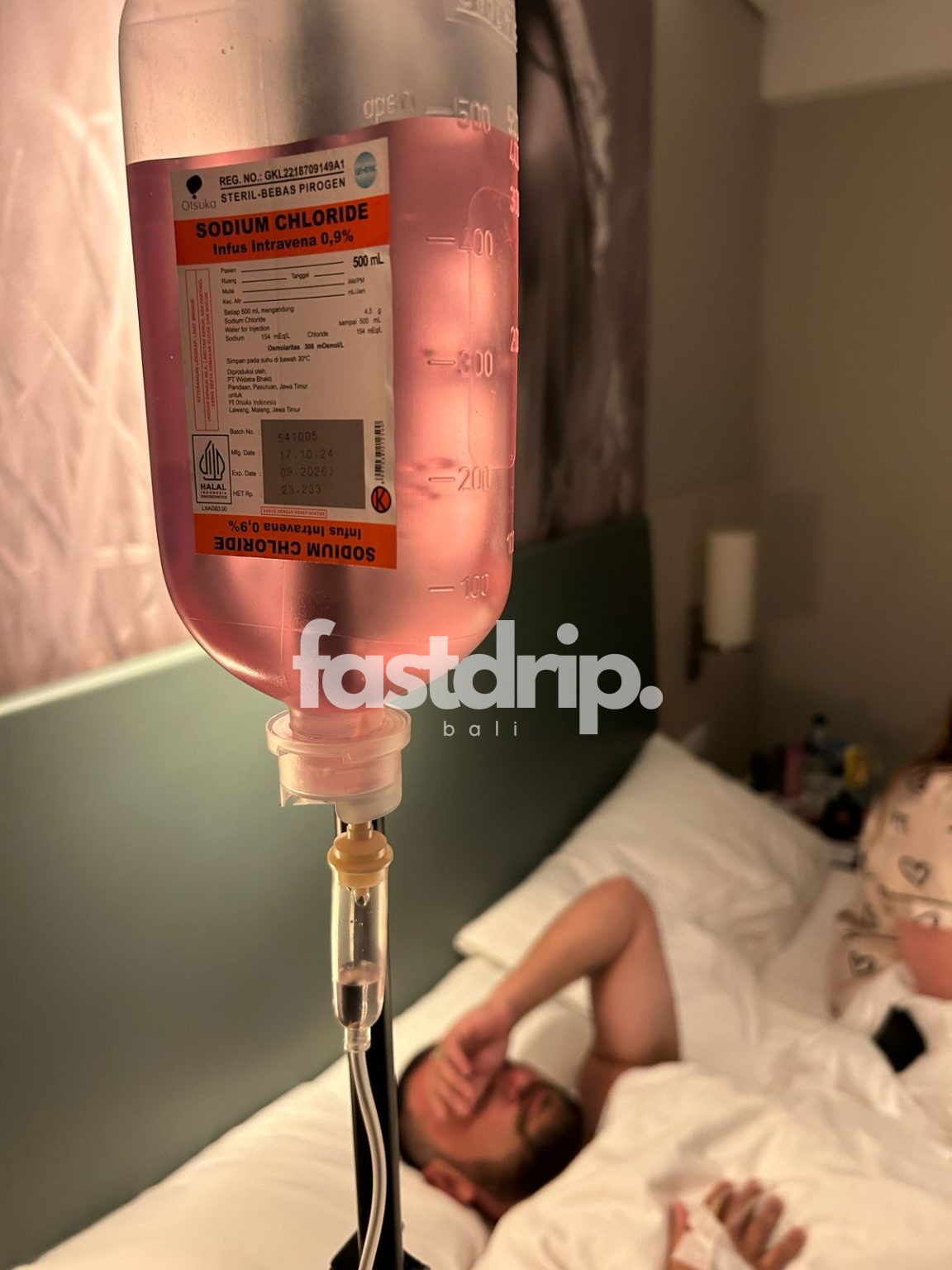 IV Drip Bali - Infusion Bali Belly